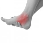 Ankle Pain